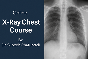 XRay Chest Course cover