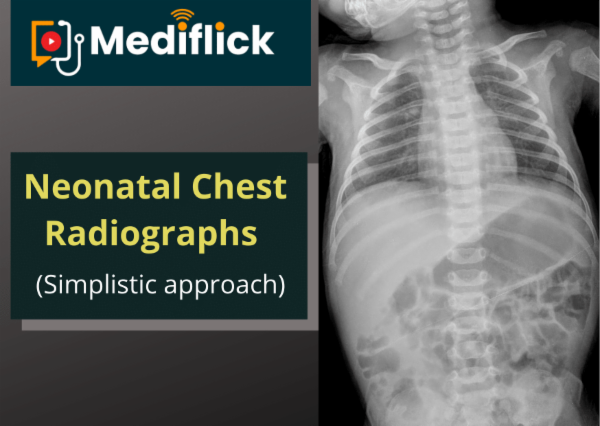 Interpretation Of Neonatal Chest Radiographs cover