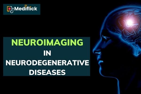 Neuroimaging in Neurodegenerative Diseases cover