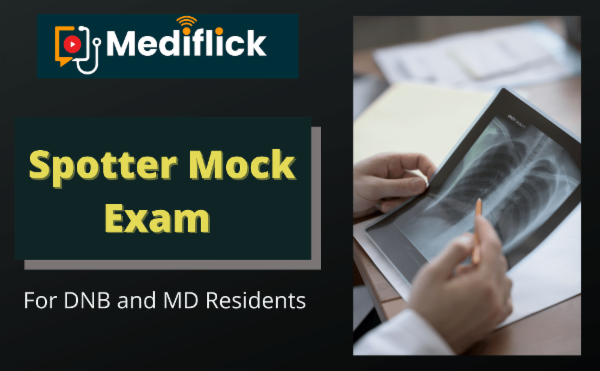 Mock Test - Spotter Session cover