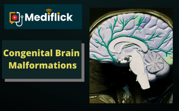 Congenital Brain Malformation cover