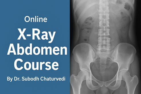 X Ray Abdomen Course cover