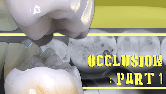 FMR: Occlusion