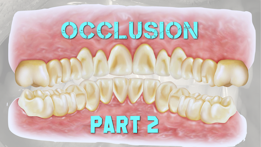 健康・医学 Occlusion FMR: Occlusion