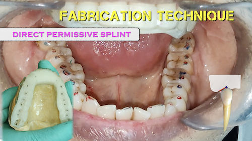 All About Splint Therapy