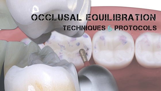Occlusal Equilibration: Techniques and Protocols cover