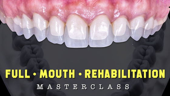 FMR: Masterclass (In-Depth Course) cover