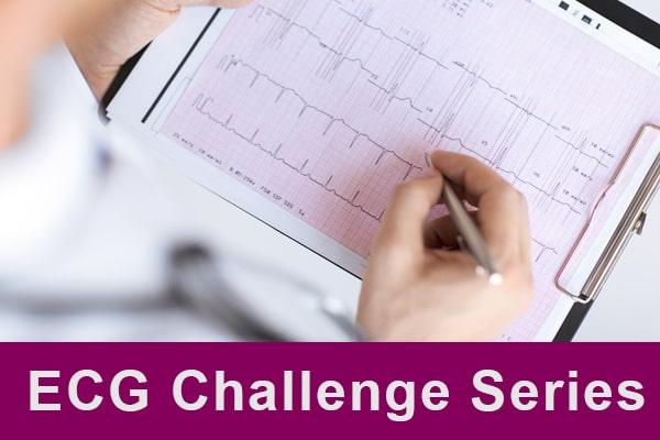 ECG Interpretation Challenge Series cover