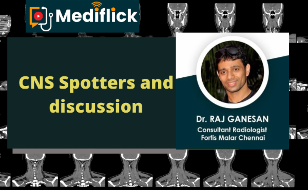 CNS Spotters and discussion cover