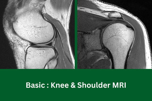 Basic :Upskill Knee and Shoulder MRI cover