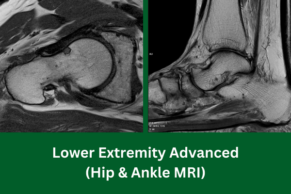Lower Extremity Advanced cover