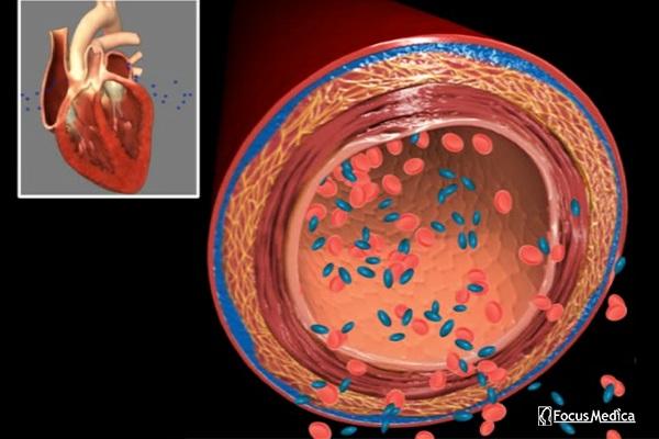 Animated Atlas of Hypertension cover