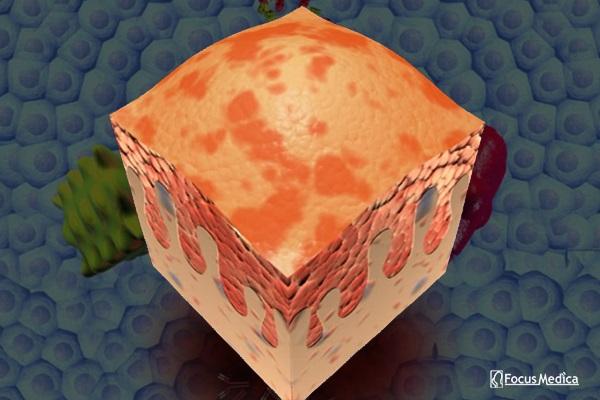 Animated Atlas of Dermatology cover