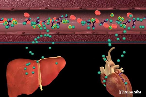 Animated Atlas of Hemochromatosis cover