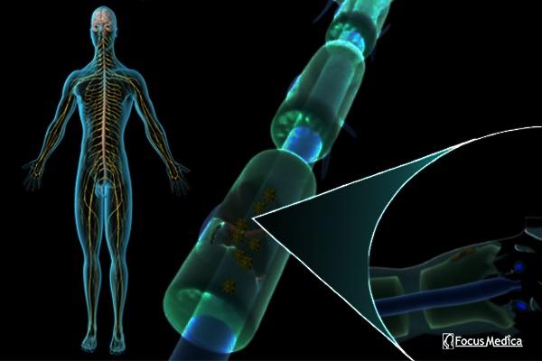 Animated Atlas of Neuropathic Pain cover