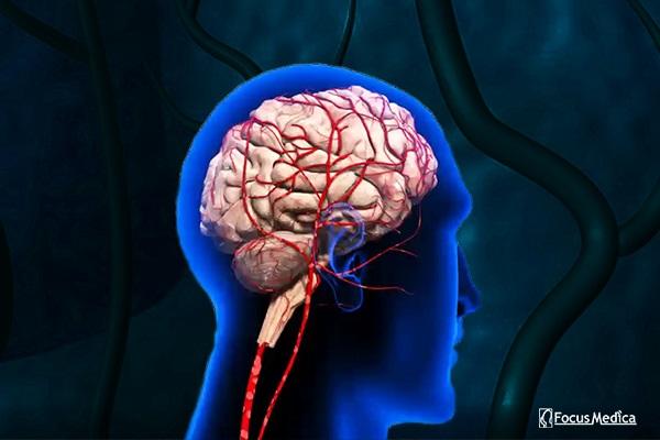 Animated Atlas of Stroke Rehabilitation cover