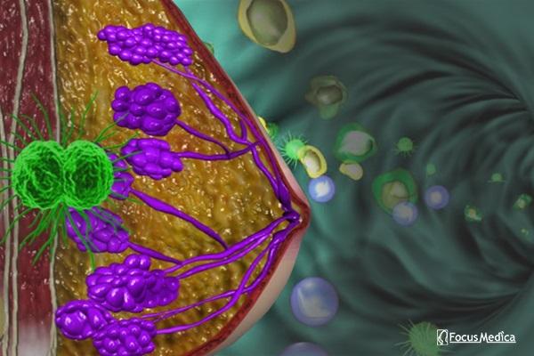 Animated Atlas of Breast Cancer cover