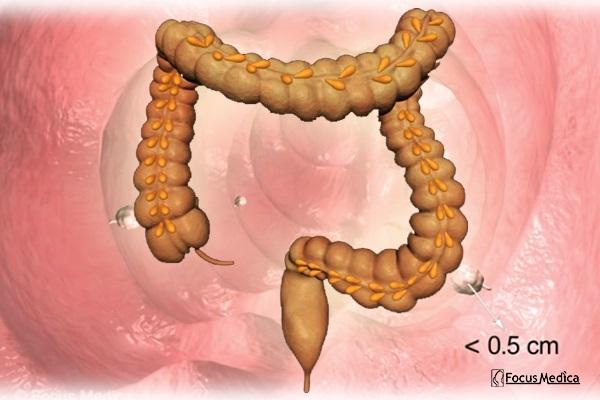 Animated Atlas of Colorectal Cancer cover