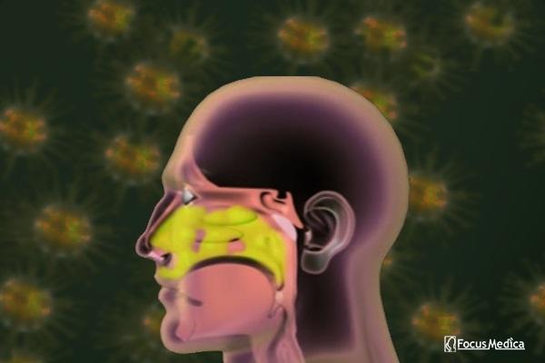 Animated Atlas of Rhinitis cover