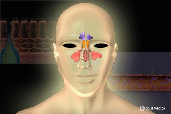 Animated Atlas of Sinusitis cover