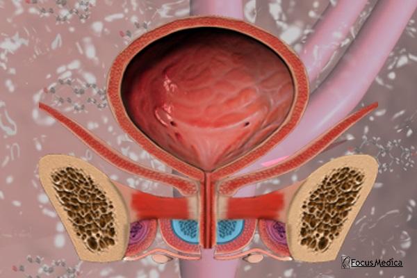 Animated Atlas of Benign Prostatic Hyperplasia (BPH) cover