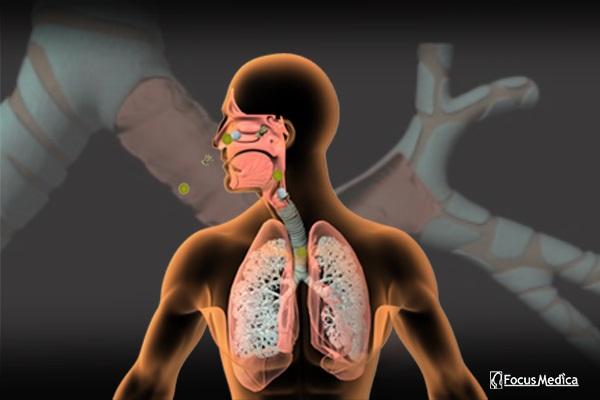 Animated Atlas of Asthma cover