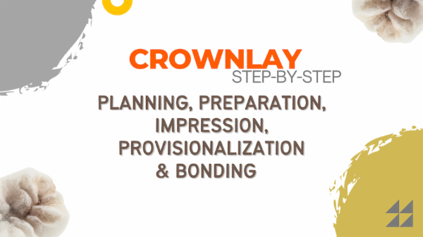 Crownlay: Step-by-Step protocol cover