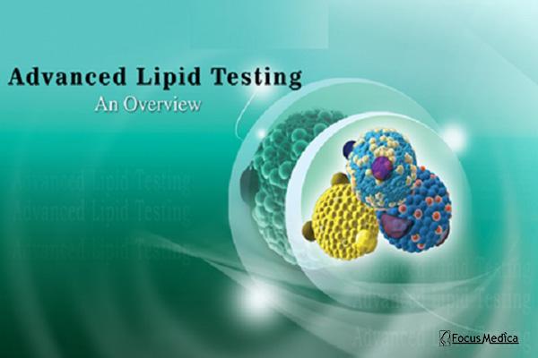 Advanced Lipid Testing cover