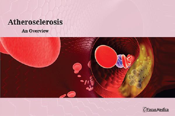 Atherosclerosis cover