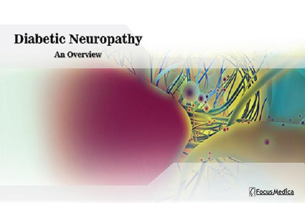 Diabetic Neuropathy cover