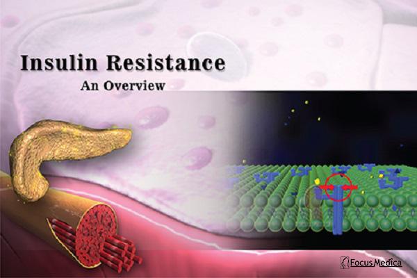 Insulin Resistance cover