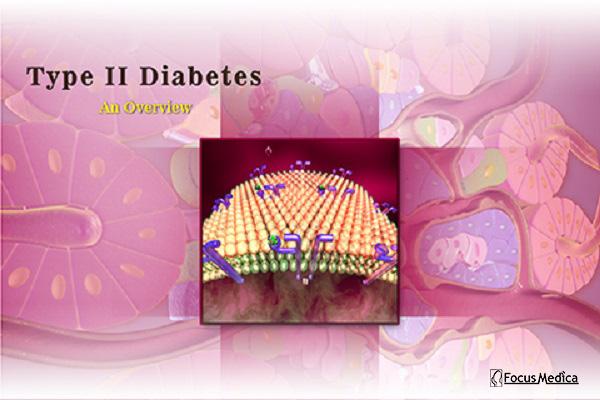 Type 2 diabetes cover