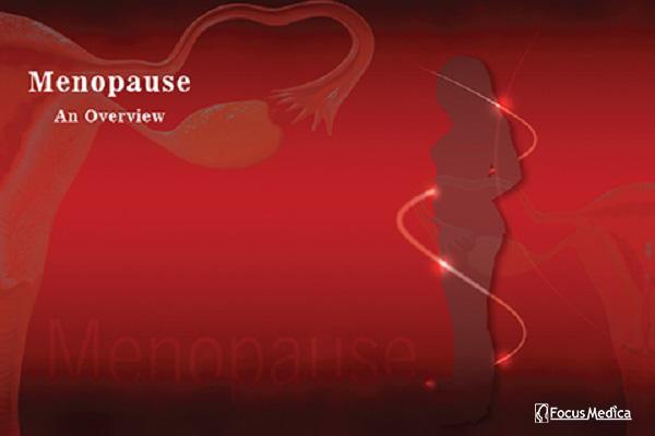 Menopause cover