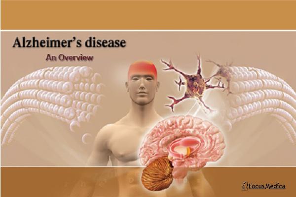 Alzheimer Disease cover