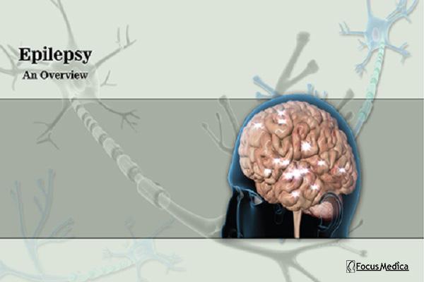 Epilepsy cover