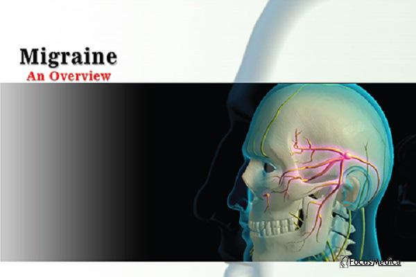 Migraine cover