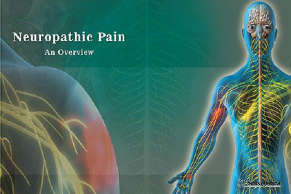 Neuropathic Pain cover