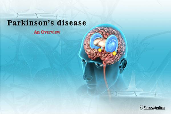 Parkinson's Disease cover