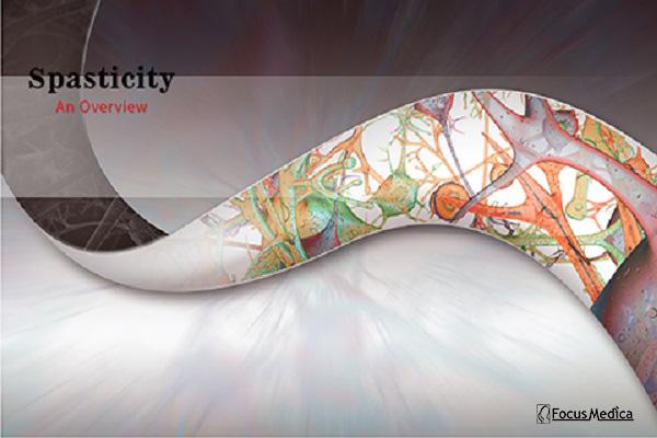 Spasticity cover