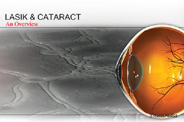 Lasik and Cataract cover