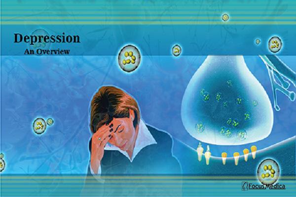 Depression cover