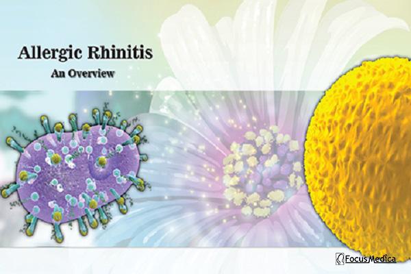 Allergic Rhinitis cover