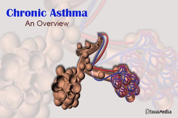 Chronic Asthma cover