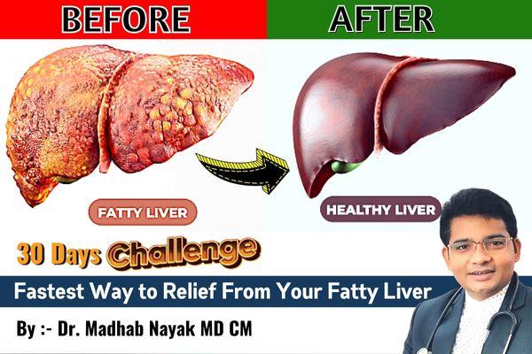 "Fatty Liver Be Gone: Your Complete Guide to Reversing Fatty Liver Disease" cover