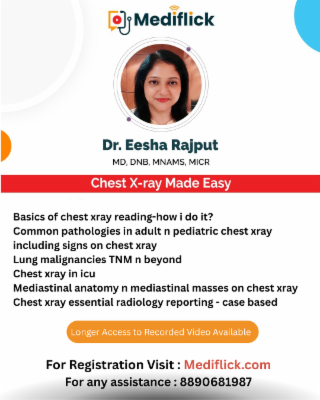 Chest X-ray Made Easy cover