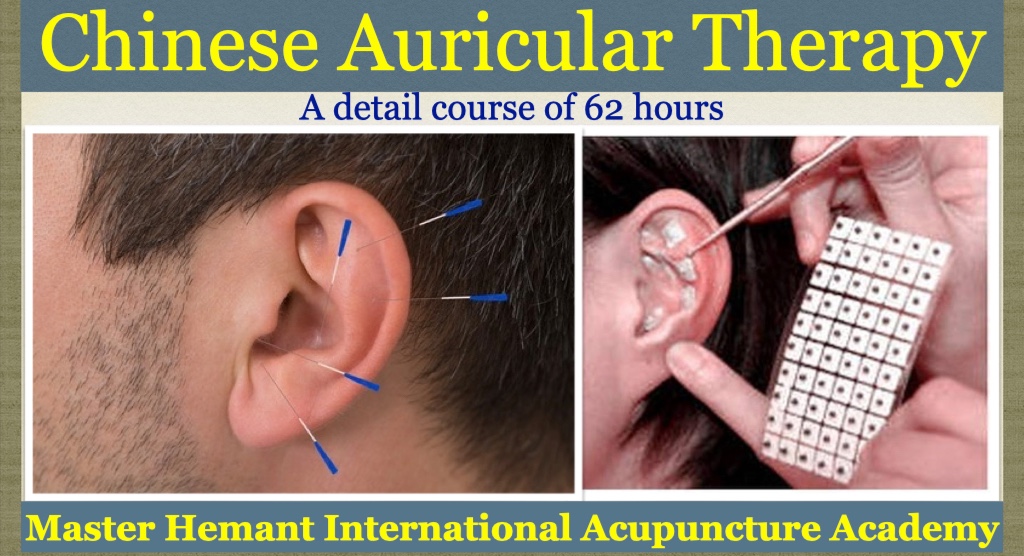 Chinese Auricular Therapy (62 Hours) cover