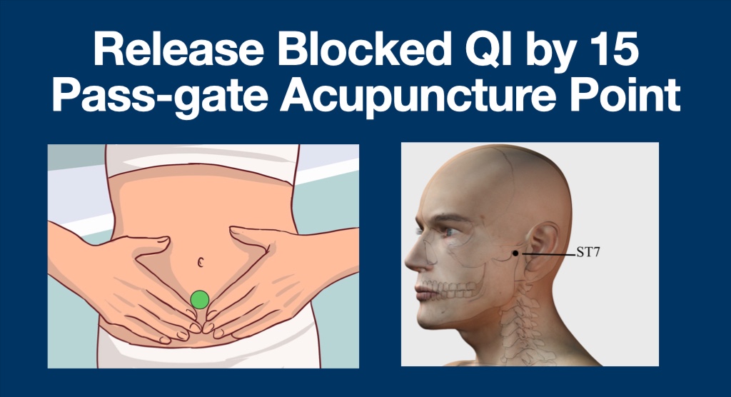 Passgate/ Barriers Acupuncture point cover