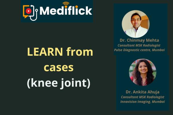 Learn from Cases - Knee Joint cover