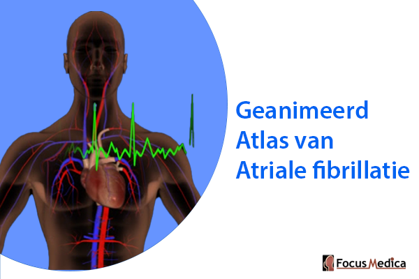 Geanimeerde Atlas van Atrial fibrillation cover