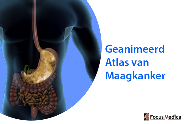 Geanimeerde Atlas van Maagkanker cover